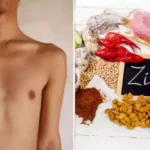 Zinc Deficiency: जिंक की कमी से धीरे-धीरे शरीर होने लगता है खोखला, खाना शुरू कर दें ये 4 चीजें 2024